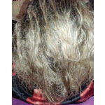 Revlon Uniq One Treatment Lotion Μαλλιών για Αναδόμηση (2x150ml) - Image 2