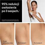 Braun IPL Epilator for Face Body & Bikini PL5221 - Image 5